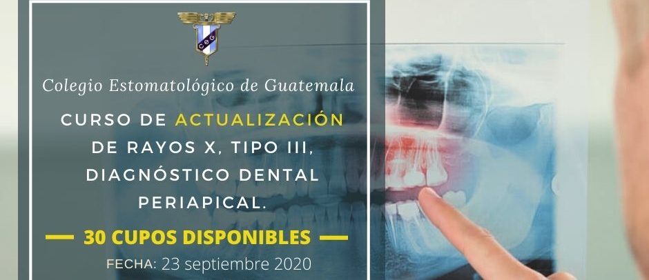 Curso de Actualización de Rayos X, Tipo III, Diagnóstico Dental Periapical – 23 de septiembre 2020